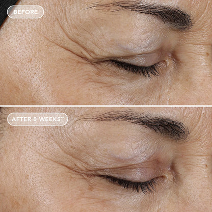 IMAGE Skincare AGELESS+ Öömask retinooliga 0,5% 50g, pilt 3