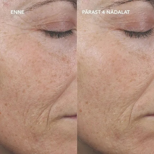 IMAGE Skincare AGELESS+ Pure Liquid Retinol 0,3% retinooliseerum, 30ml, pilt 4