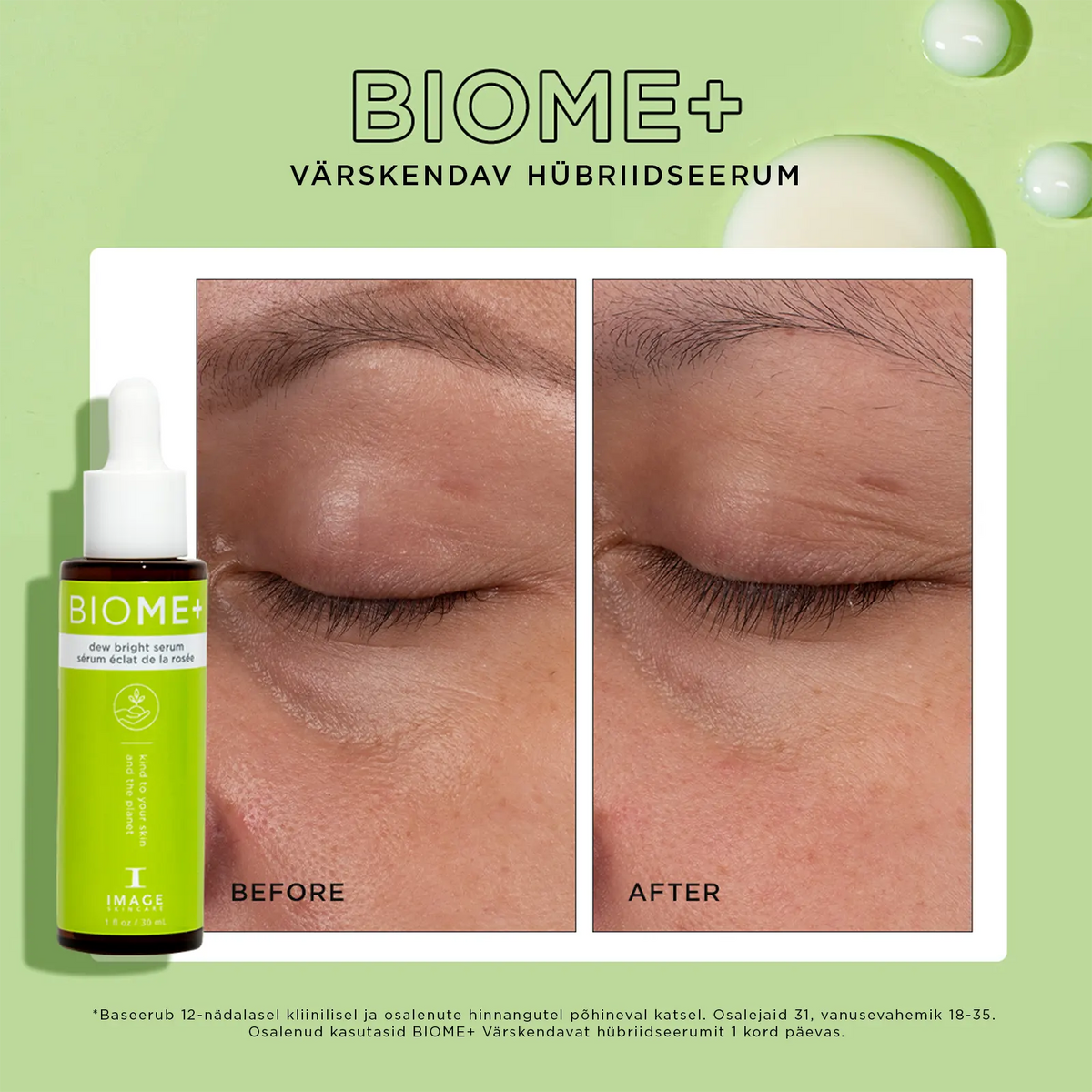 IMAGE Skincare BIOME+ Niisutav hübriidseerum, 30ml, pilt 4