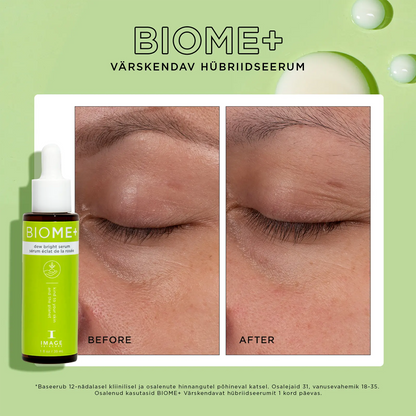 IMAGE Skincare BIOME+ Niisutav hübriidseerum, 30ml, pilt 4