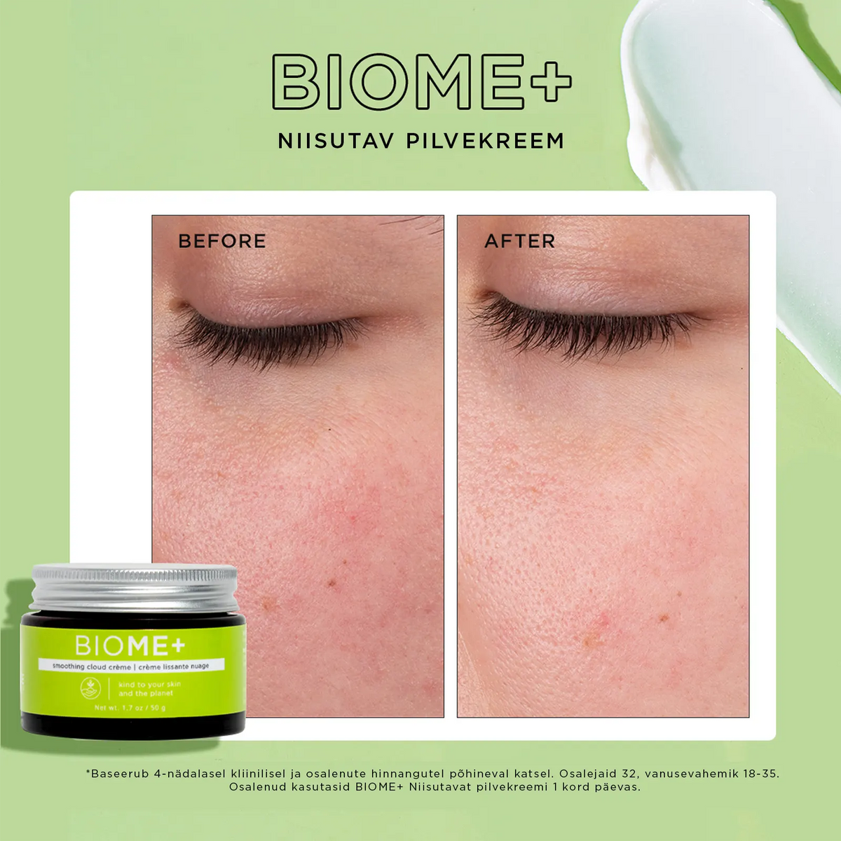 IMAGE Skincare BIOME+ Niisutav pilvekreem 50g, pilt 4