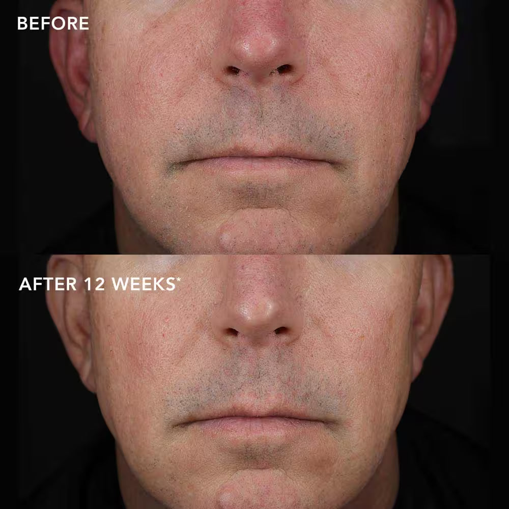 IMAGE Skincare IMAGE MD Biotech kreem 50g, pilt 4