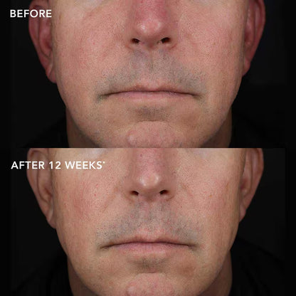 IMAGE Skincare IMAGE MD Biotech kreem 50g, pilt 4