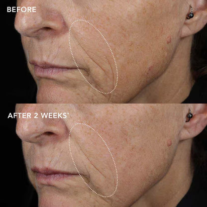IMAGE Skincare IMAGE MD Biotech kreem 50g, pilt 5