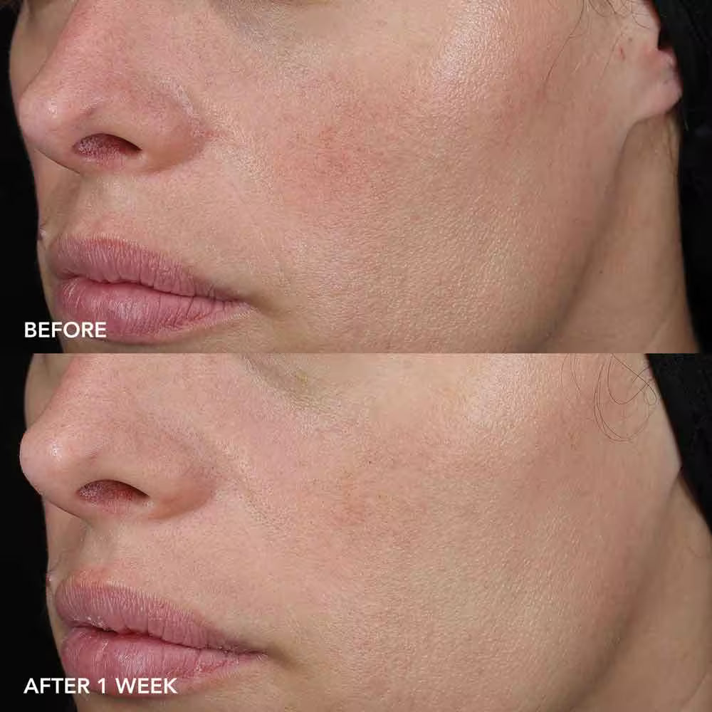 IMAGE Skincare IMAGE MD Rahustav palsam 57g, pilt 3