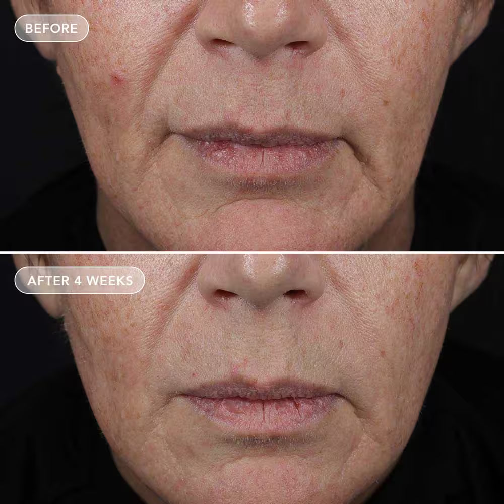 IMAGE Skincare VOL.U.LIFT 4D Skin Rebound Complex pinguldav ja täidlust taastav näokreem, 57g, pilt 3