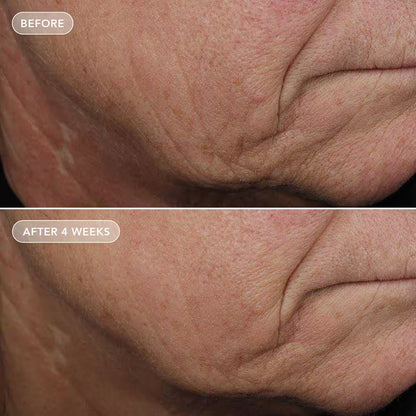 IMAGE Skincare VOL.U.LIFT 4D Skin Rebound Complex pinguldav ja täidlust taastav näokreem, 57g, pilt 4